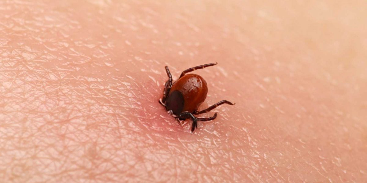 Encephalitis tick  Ticks on human skin. Ixodes ricinus can transmit both bacterial and viral pathogens such as the causative agents of Lyme disease and tick-borne encephalitis.
